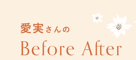 愛実さんのBefore After