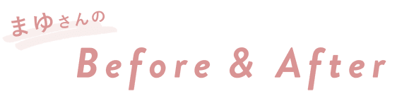 まゆさんのBefore & After